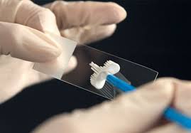 آزمایش HPV