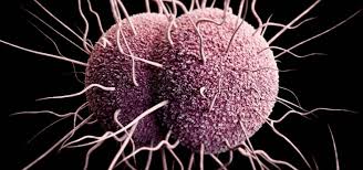 سوزاک یا گونورهآ چیست